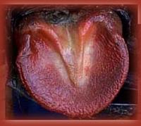 corium